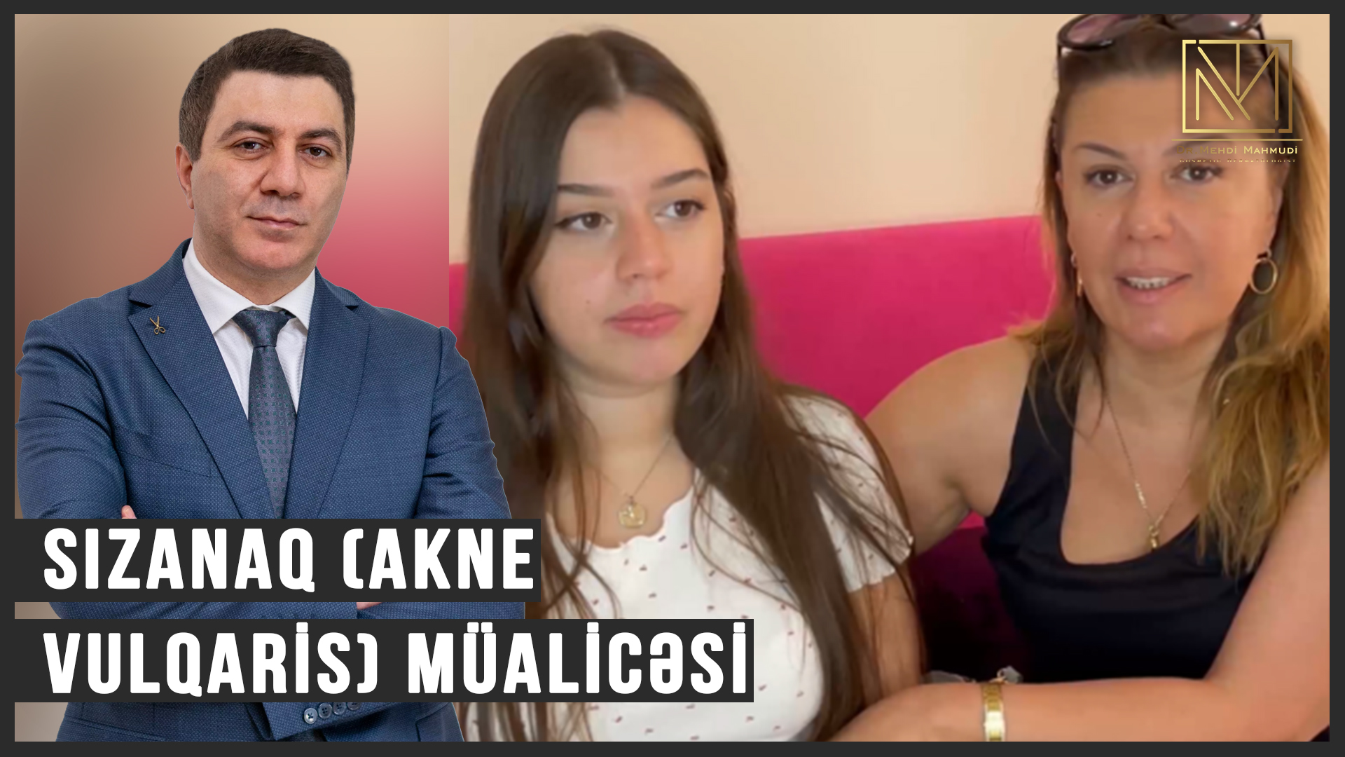 Sızanaq Müalicəsi / Acne Treatment (Akne Vulqaris)