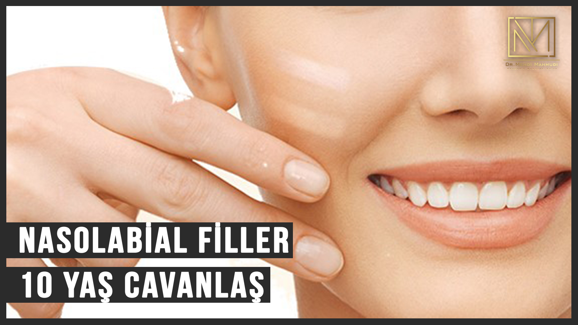 Nasolabial (Dolğu) Filler - Cosmetic Dermatolog Dr. Mehdi Mahmudi