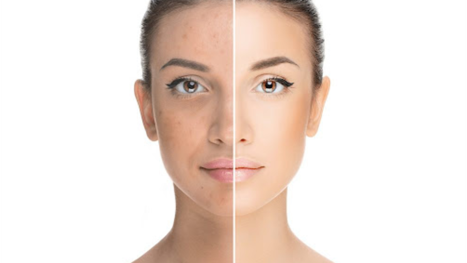 Ən Yaxşı Dermatoloq